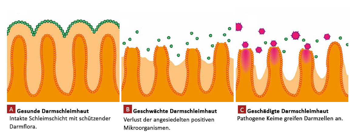 Gesunde Darmschleimhaut im Vergleich mit einer geschwächten und anschließend mit unerwünschten Keimen besiedelten Darmschleimhaut